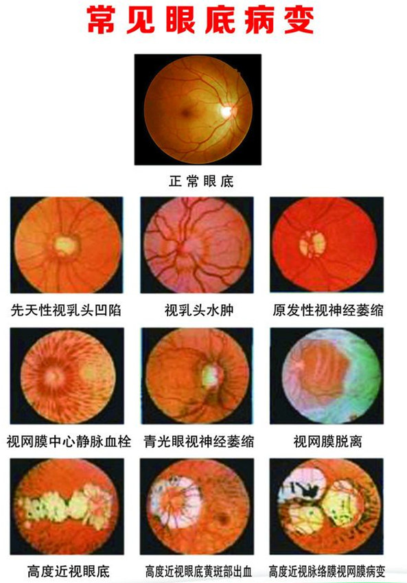 遵义哪家医院可以测视力,目明尔来青少年视力矫正中心