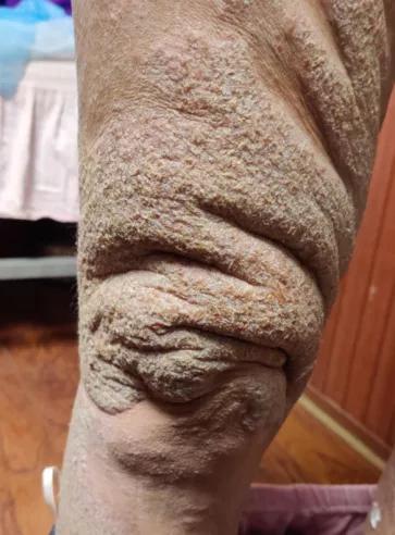 璋﹀窛涓尰,鏉窞璋﹀窛涓尰