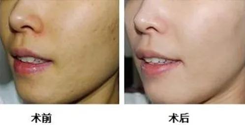 肌肤百“斑”刁难？四维瓷肌帮你终结