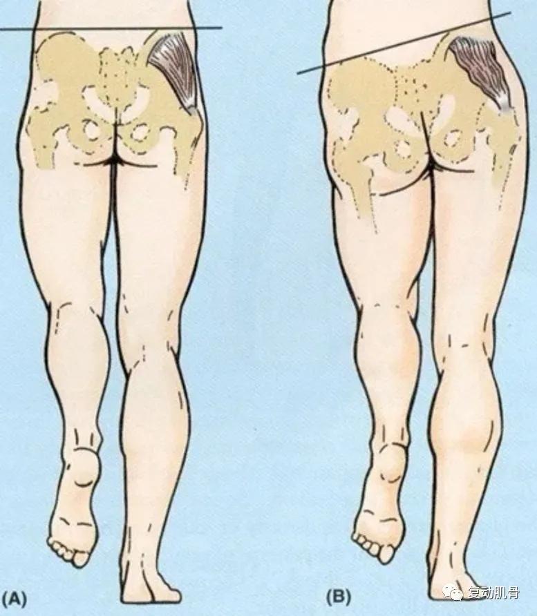 跑步时歪歪扭扭跑不直,跑步总是摇摇晃晃怎么办