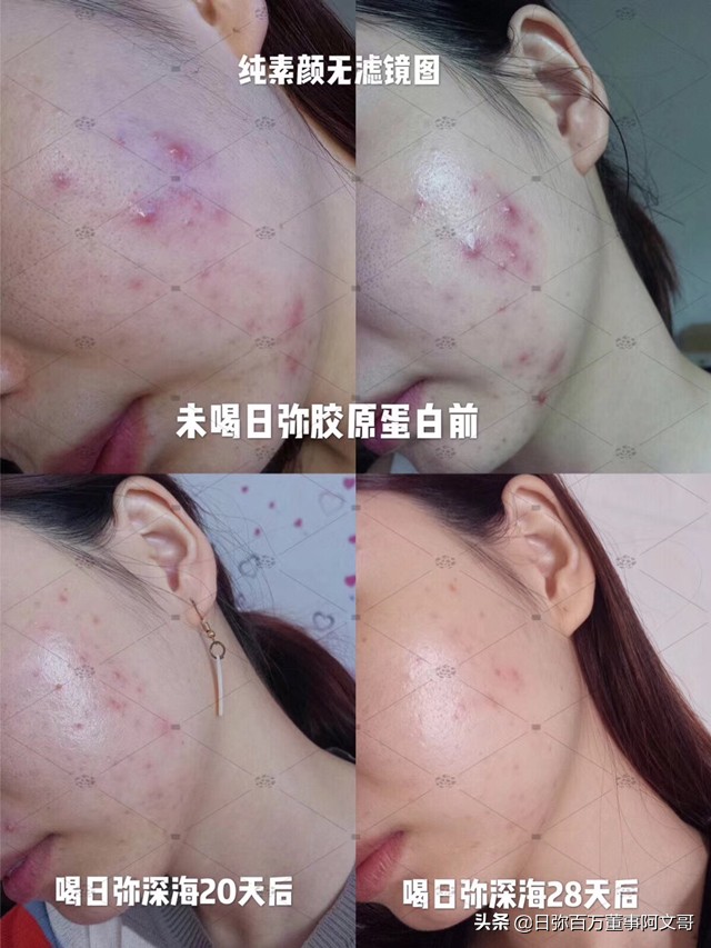 日弥深海胶原蛋白,日本nimi胶原蛋白