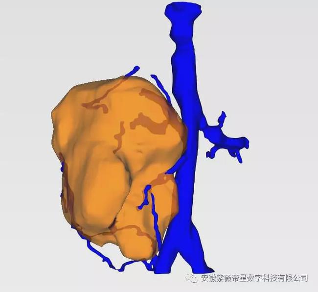 紫薇帝星穴,紫薇帝星医疗科技