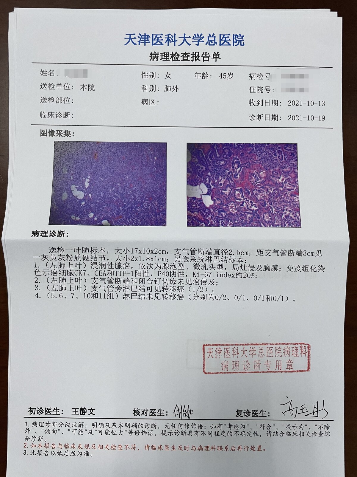 刘懿博士说肺癌,刘懿说肺结节一二三四五