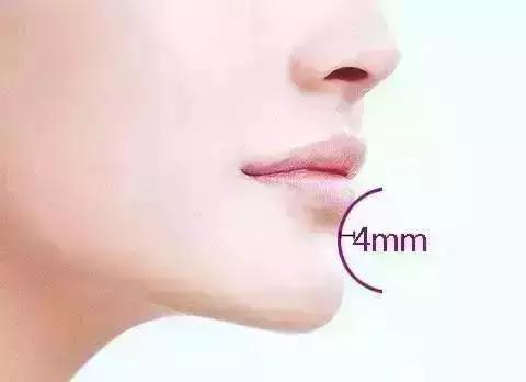 隆下巴后,整张脸都会变美了