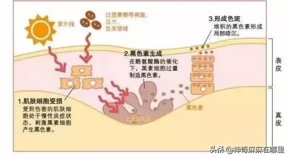 为什么用美白精华皮肤变白,为什么用了美白护肤品反而变黑了