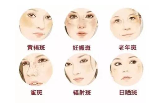 微微之光，让我记住你的美——陕西省皮防所医院超皮秒、热玛吉媒体专场活动圆满结束