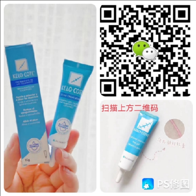 你用过最好的祛疤方法,超好用的祛疤产品