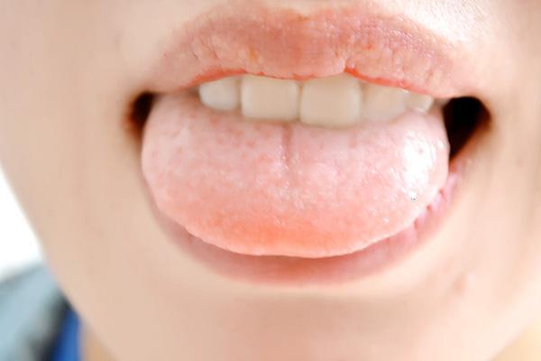 舌苔是健康“放大镜”,正常舌苔什么样?不同舌苔说明哪些问题?