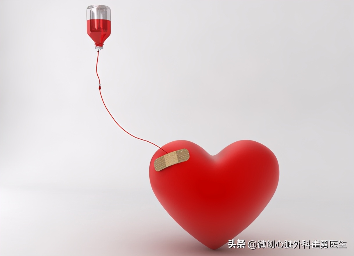 杭州心脏微创瓣膜修复术,浙江省人民医院心脏手术更安全