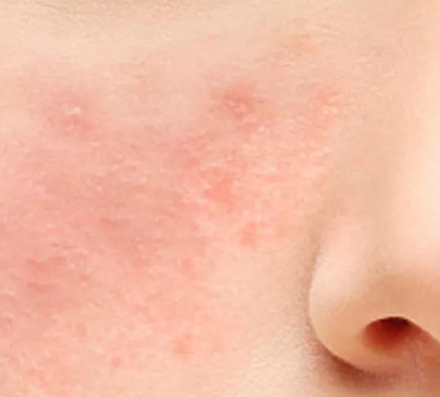 韩后神经酰胺补水保湿面膜,C5神经酰胺保湿修护面膜