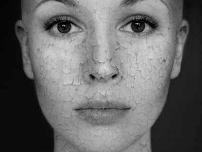 消除暗沉的最好方法,解决暗沉的有效方法