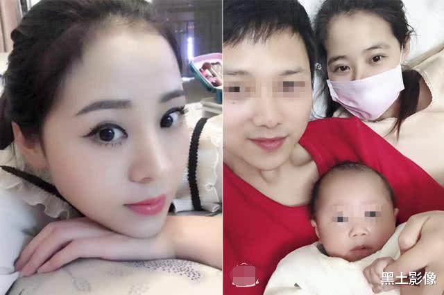 美女为生娃导致面部畸形，流浪街头自救：想活久一点，陪儿子长大