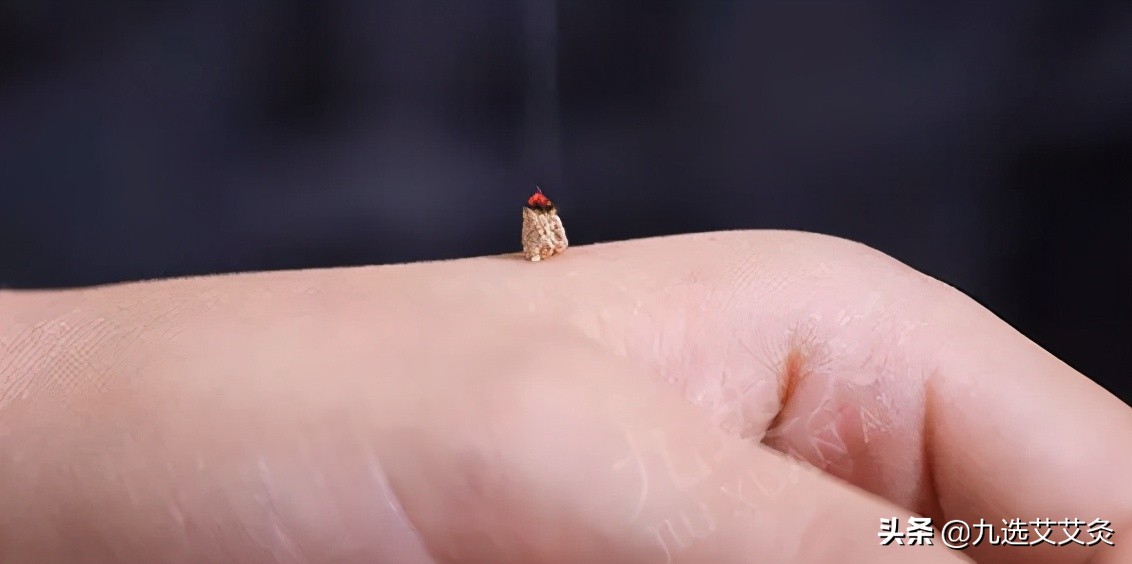 艾灸的三个阶段和十大灸感,艾灸的四种施灸手法