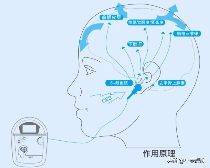 大脑失眠焦虑,严重失眠心理焦虑