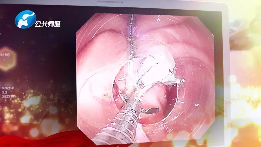 郑大一附院刘冰熔,郑大一附院刘冰熔坐诊时间