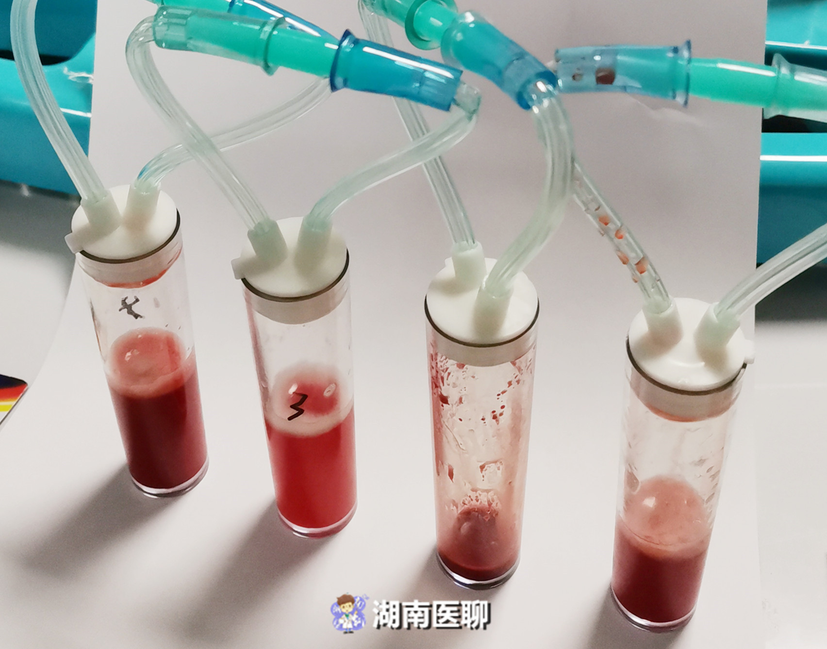 只因喝了一口田间水！花季女孩“感冒”发热，竟致中毒性休克