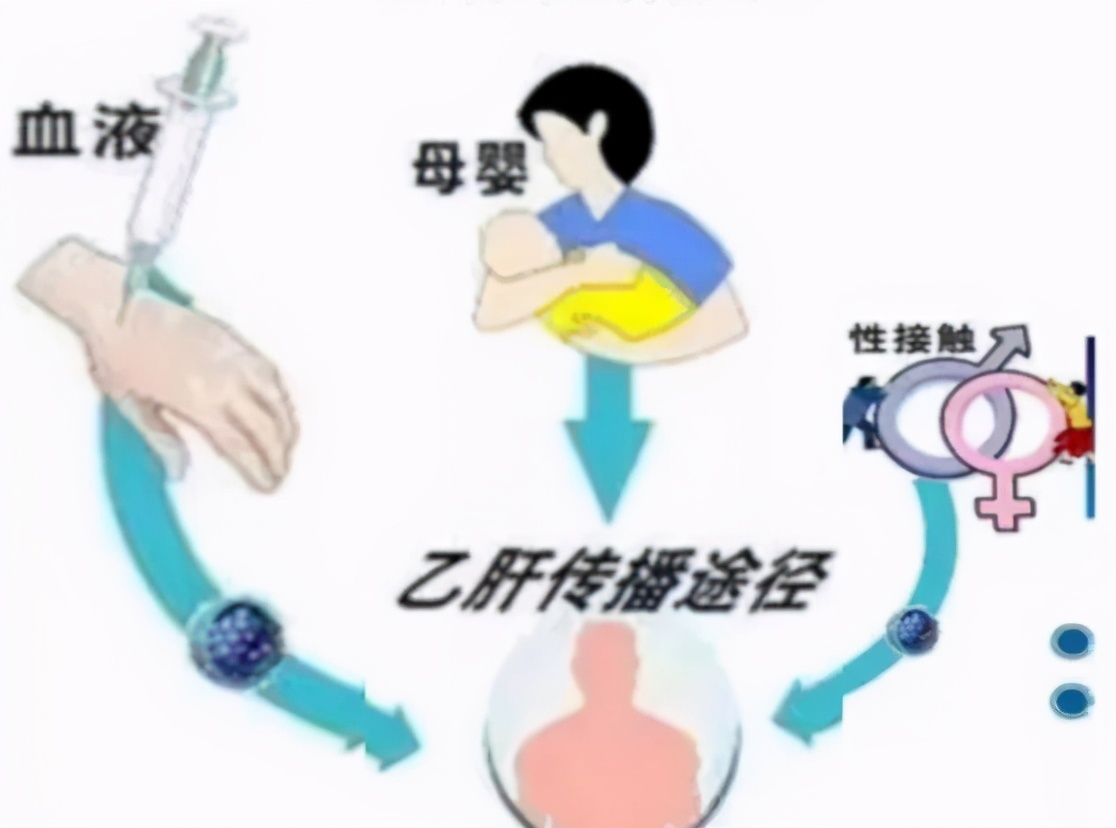 给乙肝患者的三个忠告,给乙肝患者一个忠告