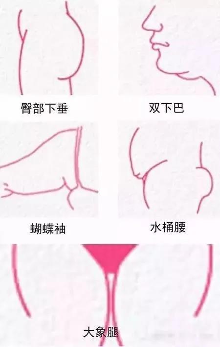 吸脂手术一秒变瘦,做了吸脂手术再减肥还能瘦么