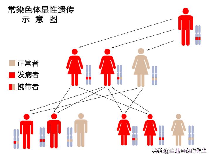 备孕前有染色体异常怎么办,备孕要注意哪些遗传病史
