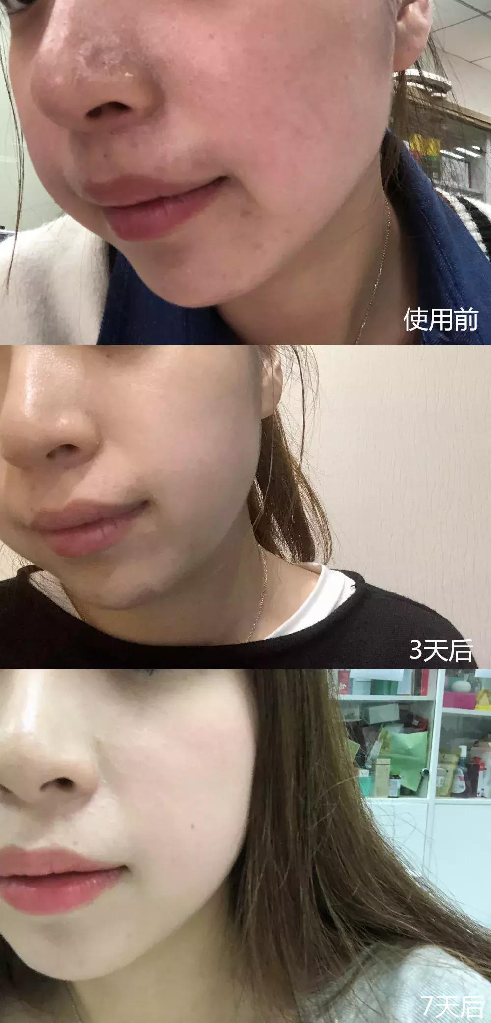 适合皮肤暗黄的护肤品李佳琦推荐,淡斑提亮肤色李佳琦推荐