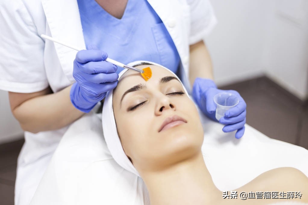 面部血管瘤治疗的最佳方法,面部血管瘤激光后多久恢复正常