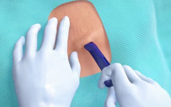 心跳脉搏监测仪器,24小时心跳动态监测器