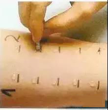 过敏是免疫系统弱还是过强,皮肤容易过敏是免疫系统问题吗