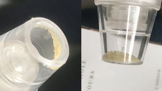 解决顽固黑头轻松去除草莓鼻,祛闭口粉刺草莓鼻