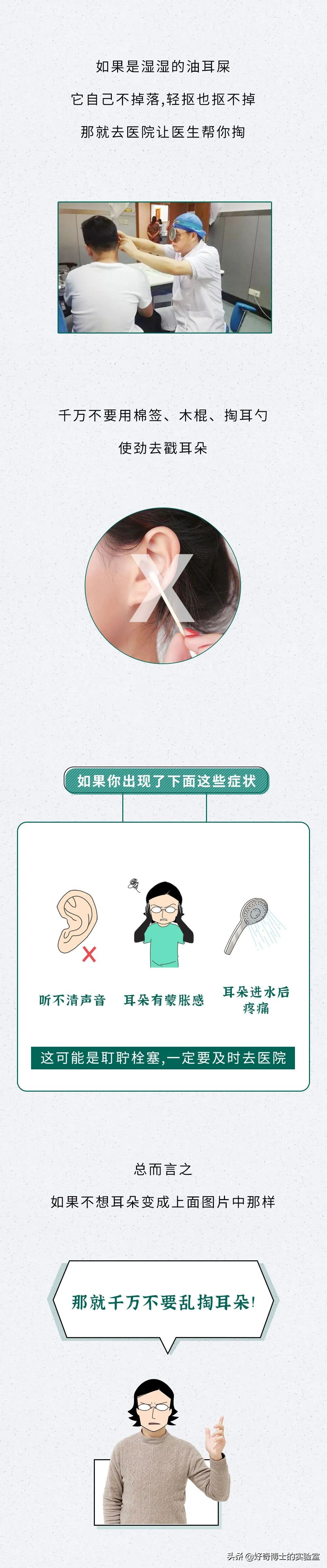 看看8年没有掏耳屎是什么样子,十年不掏耳屎你耳朵有多脏