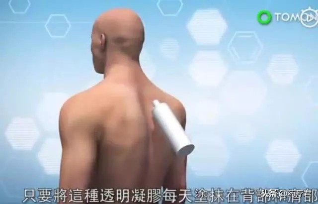 男士避孕凝胶副作用,男性避孕凝胶套