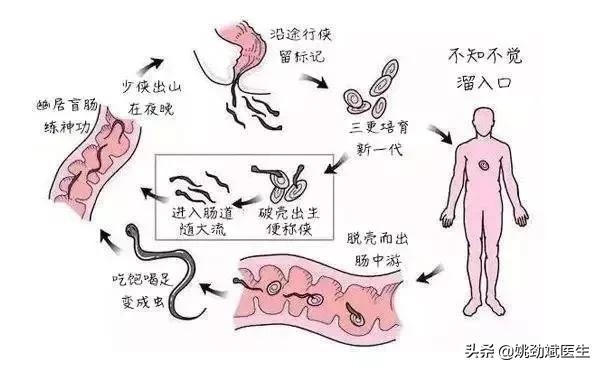 皮肤病是怎么引起的肛门瘙痒症,有哪些特效药可治肛门瘙痒症