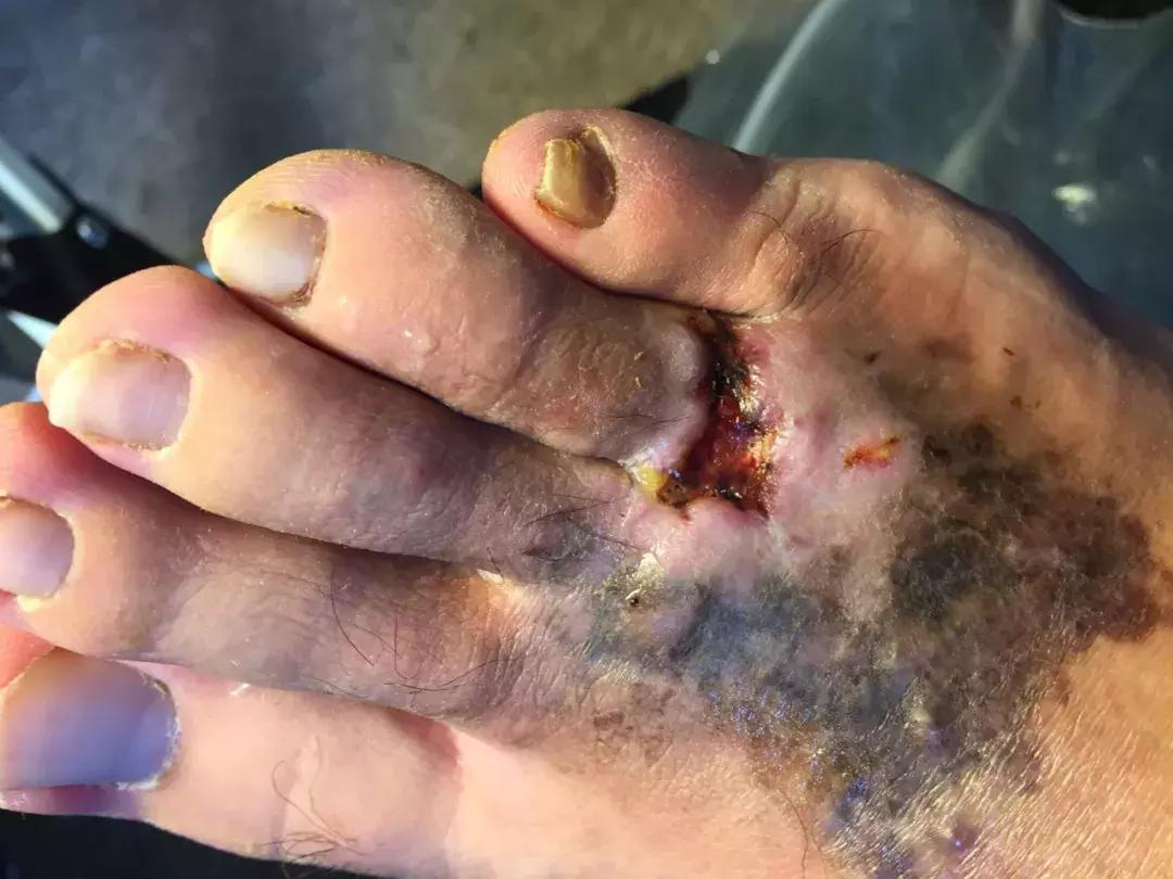 硬核玩家完整,硬核玩家完整版