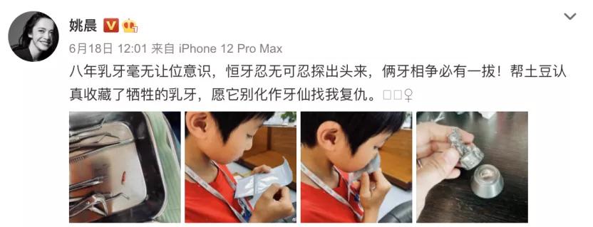 姚晨自曝儿子换牙问题,很多孩子中招!牙齿健康,家长们都要注意