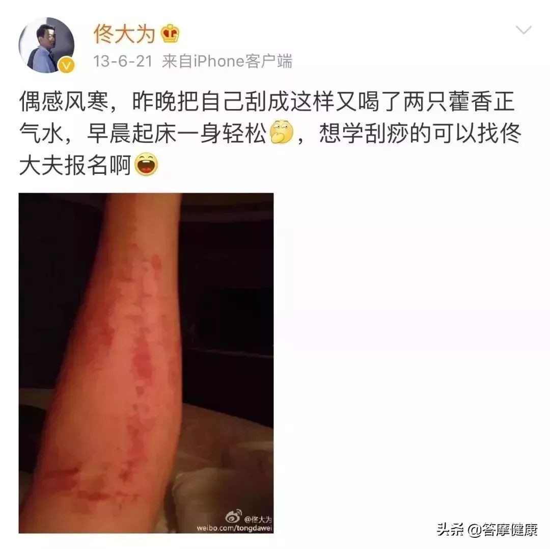 年过三十面部下垂，告诉你提拉紧致的秘技