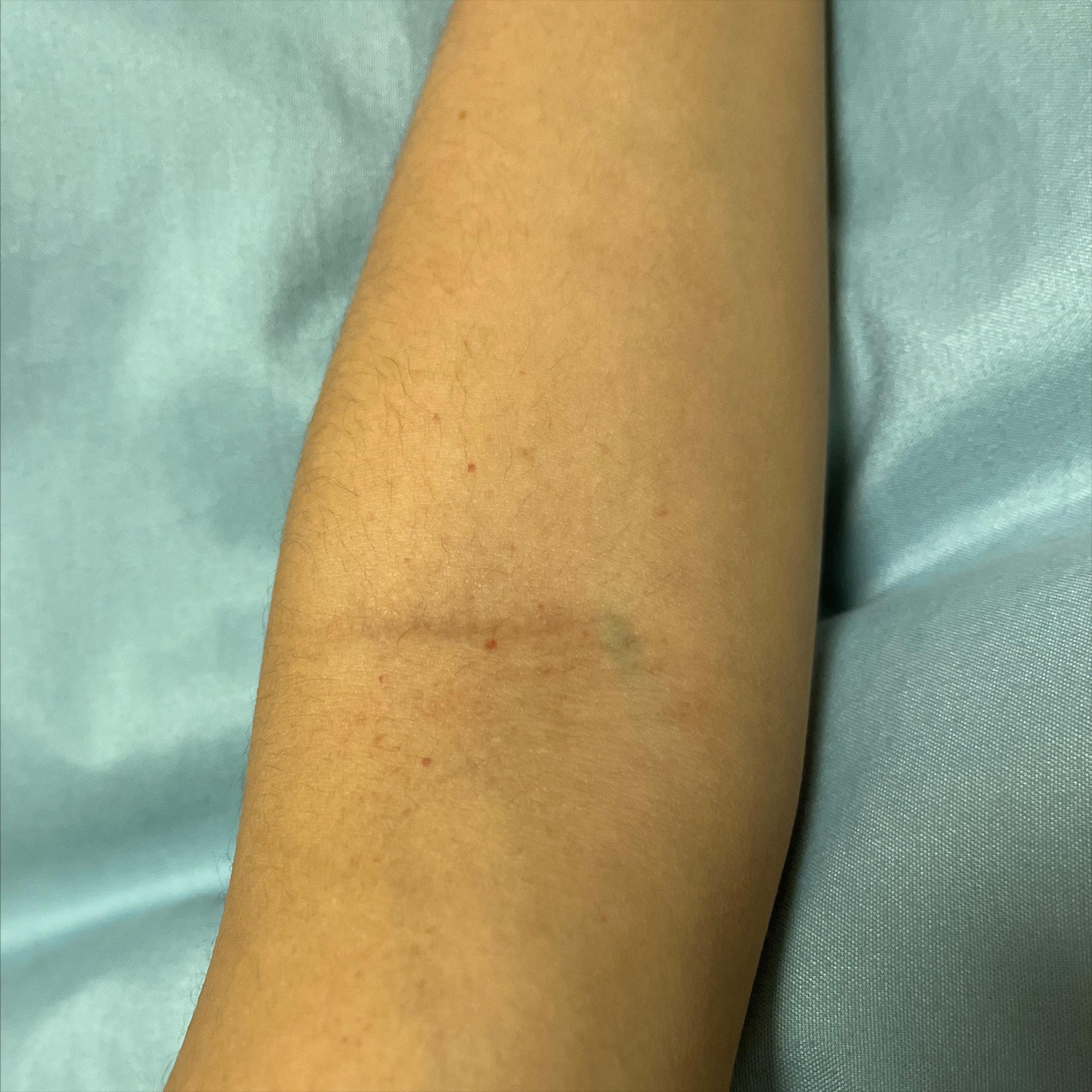 手臂有小红点是什么原因,手臂上出现很多小红点是什么原因