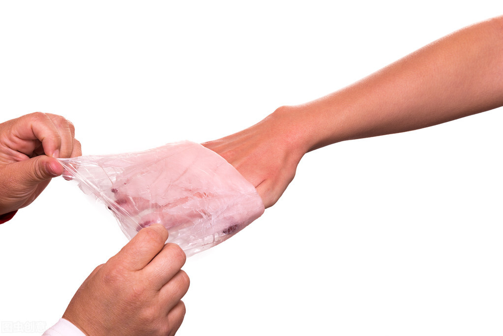 手术切除黑痣,手术摘除黑痣后续处理