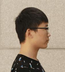 听说这个动作能治耳鸣耳聋,治疗耳鸣的死穴在哪里