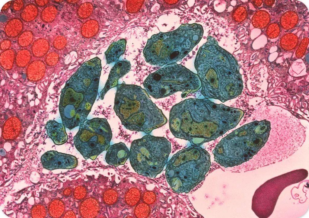 弓形虫怎样从动物中传染到人类,弓形虫的主要宿主