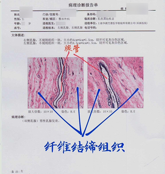 孩子虚胖是什么原因,儿子胸部肥胖怎么解决