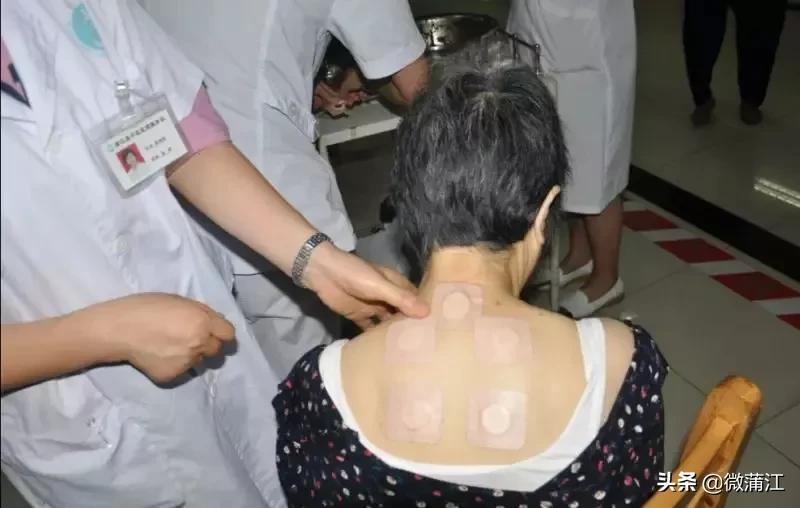 三伏贴中医院,中医院的三伏贴