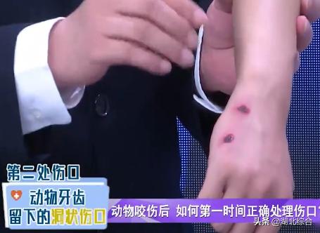 伤口没流血还需要消毒吗,被猪咬了流血了需要打狂犬疫苗吗