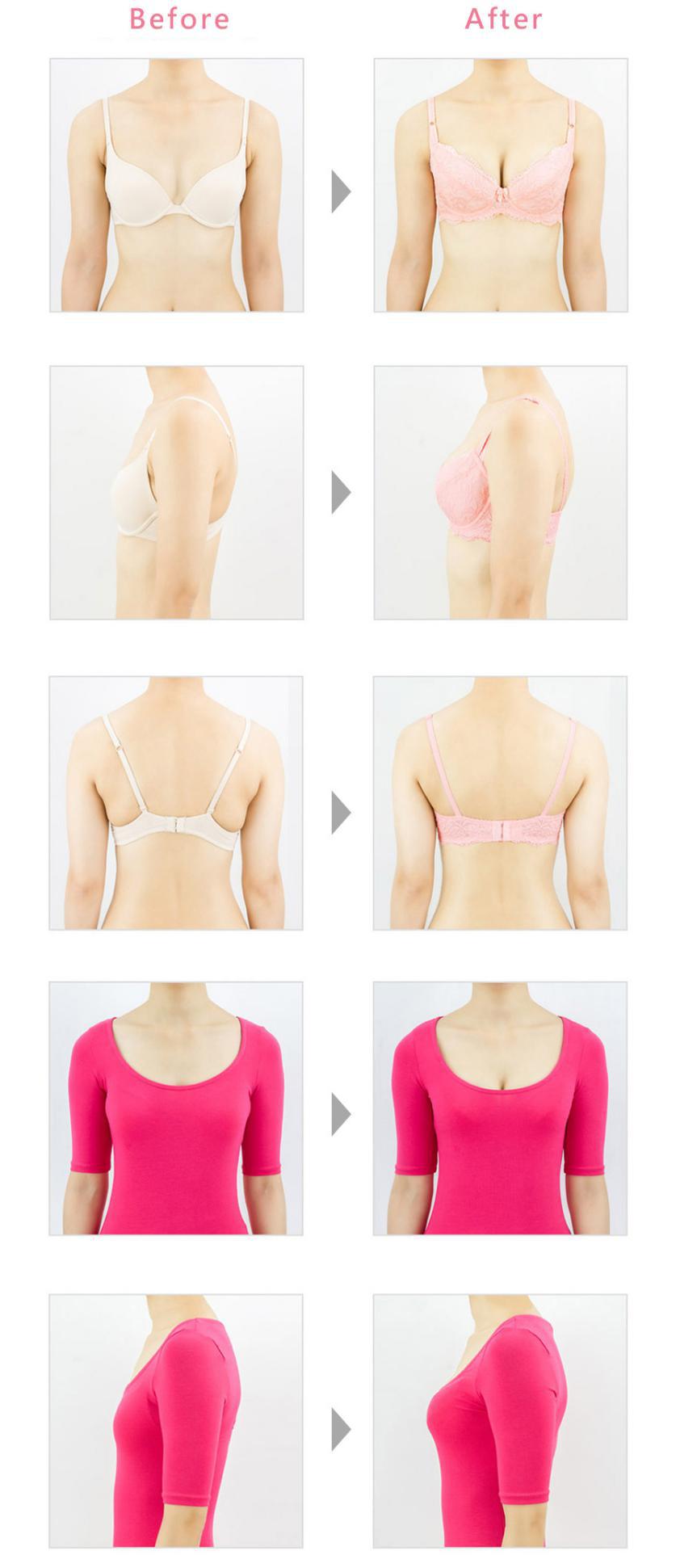 少一个乳房适合选什么内衣,适合乳房内陷的内衣