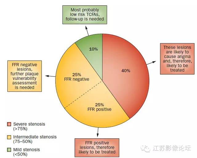 冠脉CT血管造影诊断高危斑块病变影像学特征分析