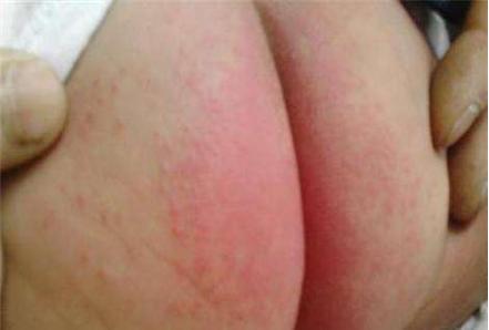 适合宝宝使用的纸尿裤品牌,宝宝纸尿裤贴身穿吗