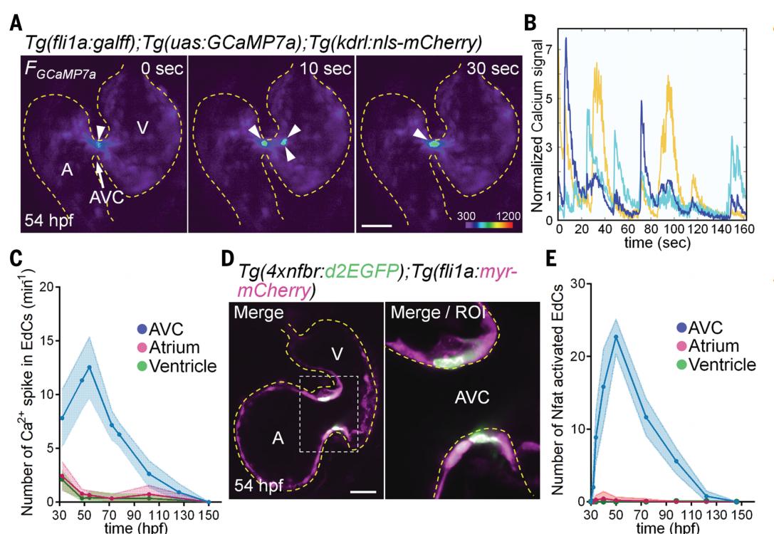心脏机械瓣膜的工作原理,人工心脏瓣膜的产生与进展