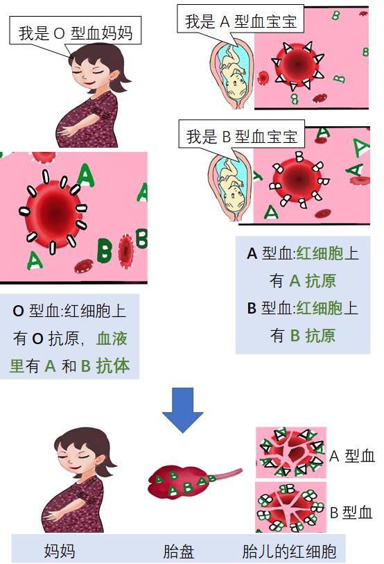 黄疸吐出来了怎么回事,新生儿黄疸是怎么回事