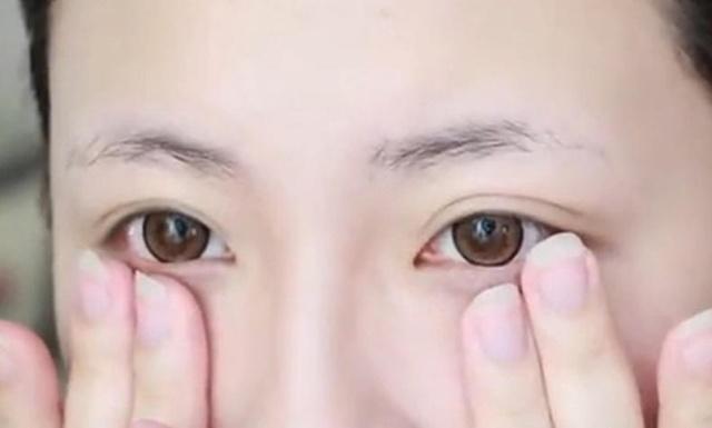 才20岁眼角有细纹怎么办,年纪轻轻眼角纹很严重