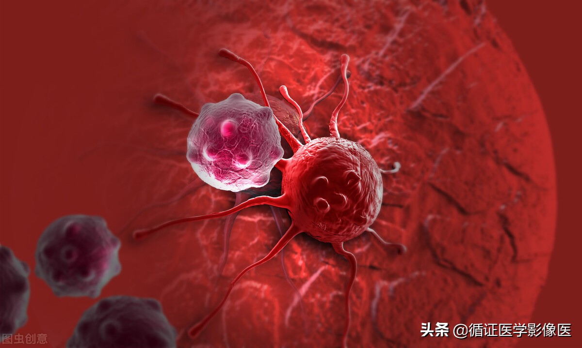 日本癌症患者的生存率为啥那么高,日本乳腺癌发病率是多少