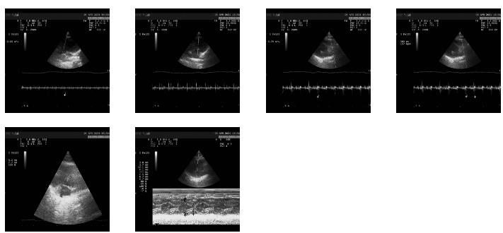 “喵“生绝育大事,腹腔镜下“微”察秋毫,让疼痛降到更低
