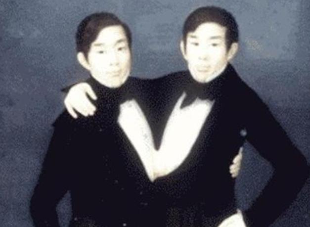 连体人是如何结婚生子呢,连体人结婚生了孩子是什么样子